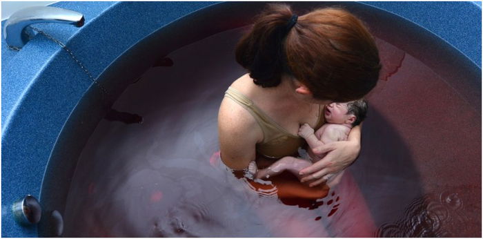 Is Water Birth Less Painful? Here's What You Need to Know About It
