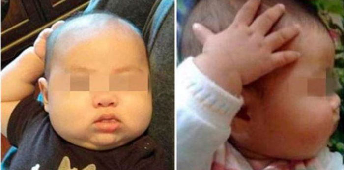 What Does It Mean When Your Baby Scratches His Head Often?