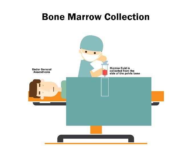 bone marrow donation in Singapore