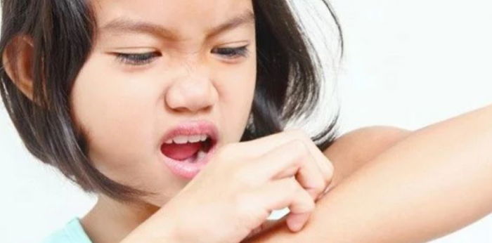 Recognise the Ring of Red: Ringworm Causes, Symptoms and Treatments