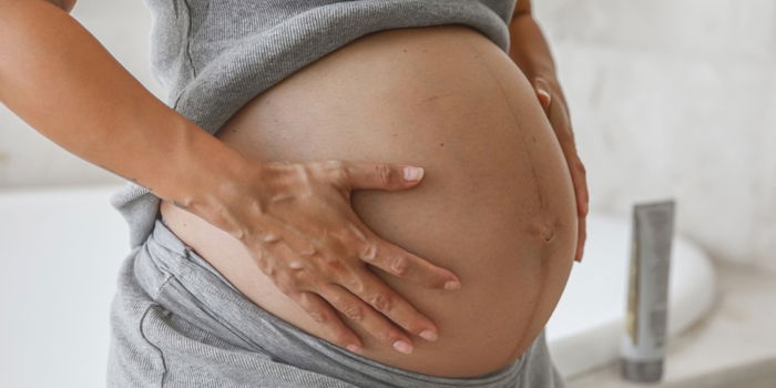Too Much Amniotic Fluid: 10 Symptoms of Polyhydramnios In Pregnancy