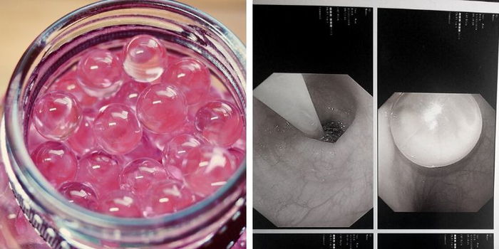 Mum Warns Of Danger After Toddler Ends Up In Hospital For Swallowing Water Beads