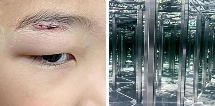 8-Year-Old Boy Gets Injured While Playing At Jewel Changi Airport