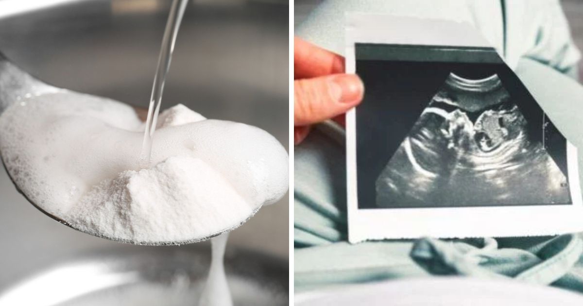 Baking Soda Pregnancy Test At Home Is It Really Reliable?