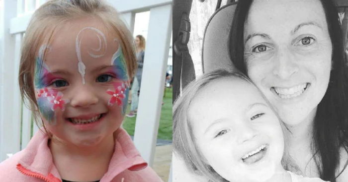 The Upside of Down Syndrome