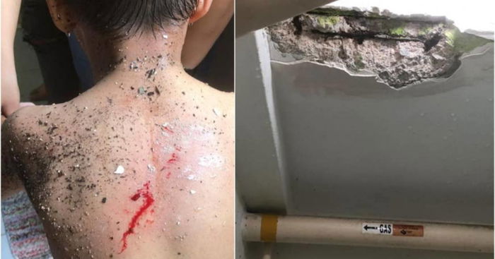 Concrete Slab Falls From HDB Flat Ceiling, Strikes Boy's Back