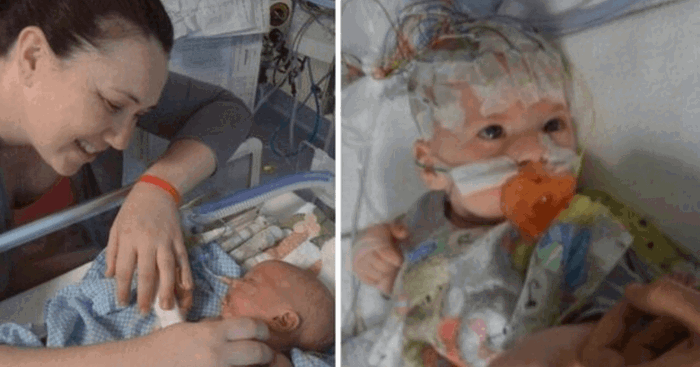 'When Hazzi was born, he turned an extremely scary shade of blue'