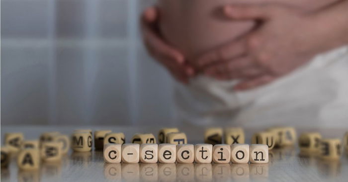 C-Section Complications: A Doctor’s Advice On Hidden Complications And Preventive Measures