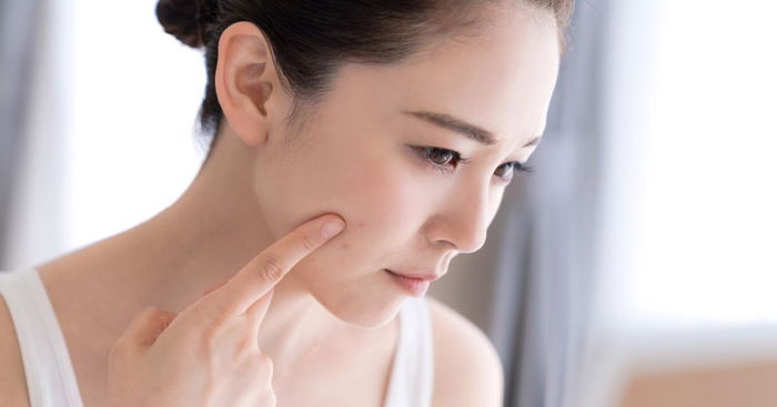 5 Hacks to Improve Your Skin Texture and Complexion