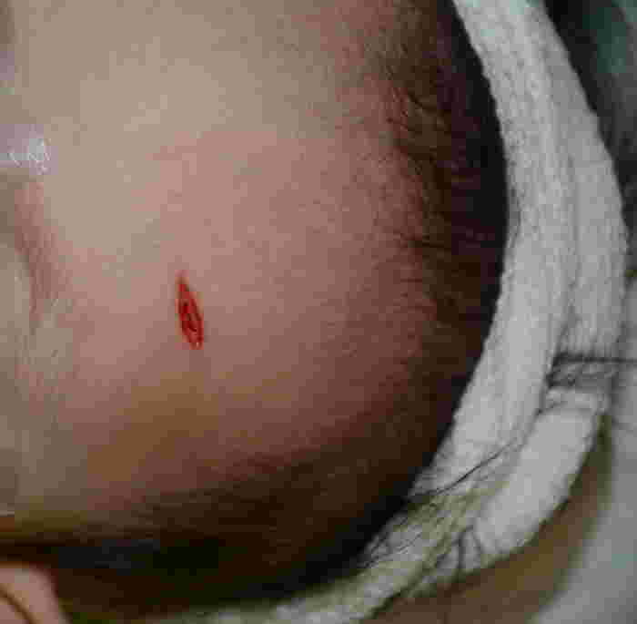 Maplebear Moulmein incident