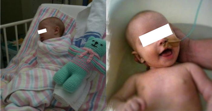 Silent Reflux In Babies: 'She was screaming like she was being stabbed'