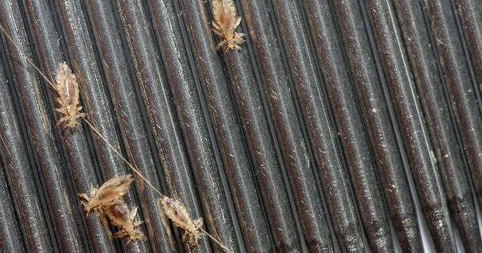 12-year-old Girl Dies After Severe Head Lice Infestation Causes Heart Attack, Parents Charged