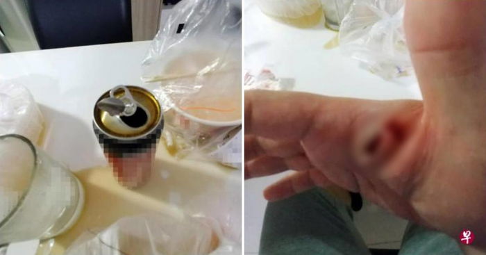 'Exploding' Canned Drink From Delivery Leaves Customer With 3 Stitches on His Hand