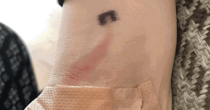Mum’s Warning on Monitoring Your Kid’s Cuts and Grazes