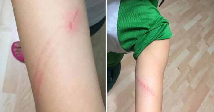 9-year-old Allegedly Abused At Singapore Childcare Centre After Returning 30mins Late From Lunch, Police Investigating