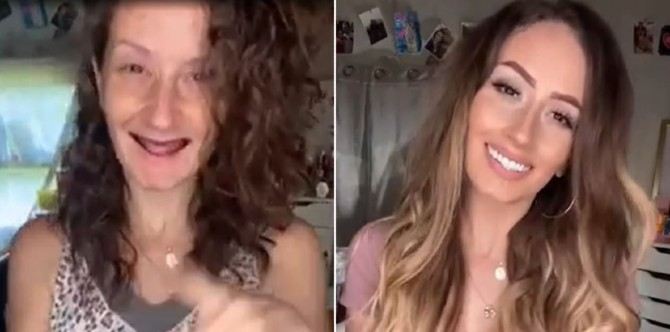Mum Shares Inspiring Transformation Story After Losing Her Teeth During Pregnancy