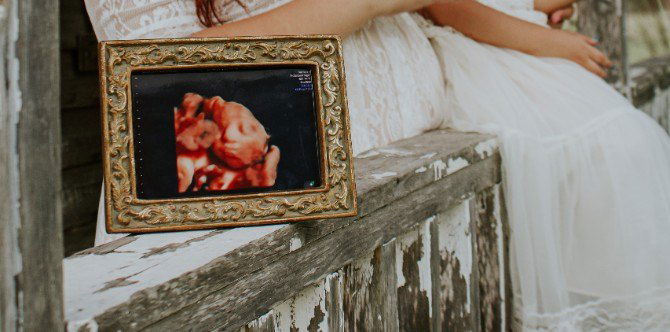 4D Ultrasound Tests: Everything You Need To Know About It