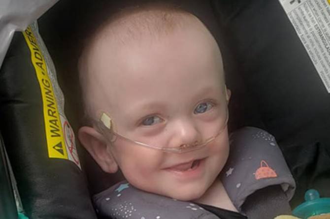 premature baby health issues