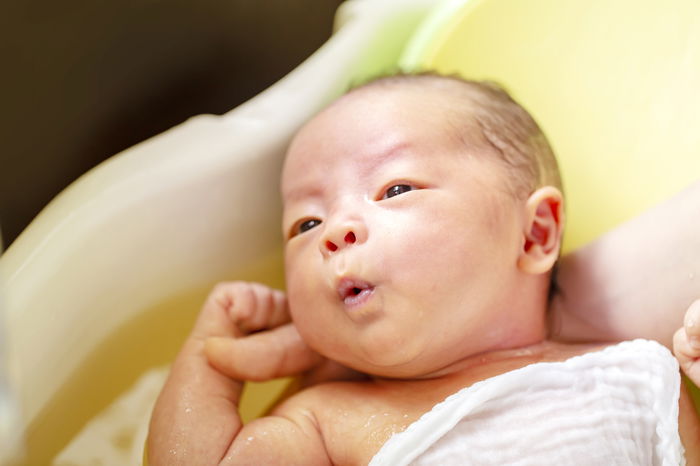 Stay Alert: Don't Ignore These Minor Conditions in Your Newborn