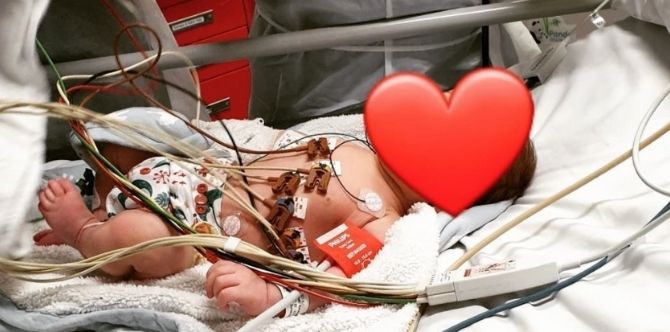 Mum Performs CPR On Her 7-Week-Old Baby After He Suddenly Stops Breathing