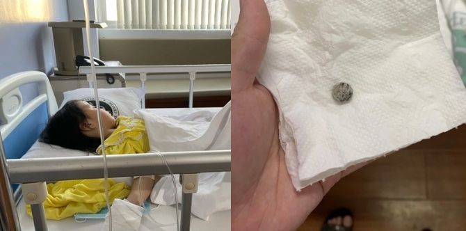 "My Toddler Swallowed A Button Battery!"