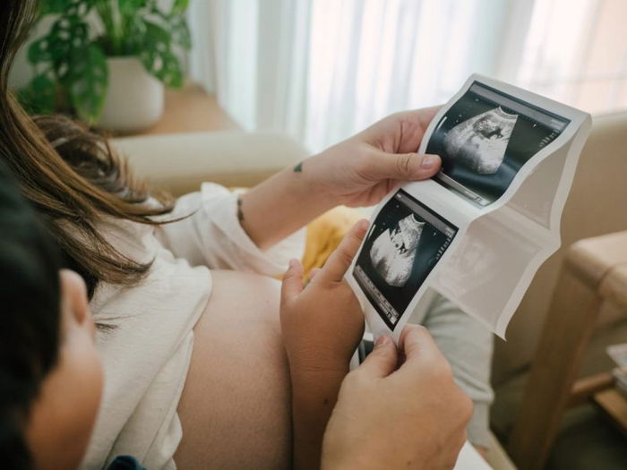 Woman Pregnant With Quadruplets - Delivers Four Babies on Different Days