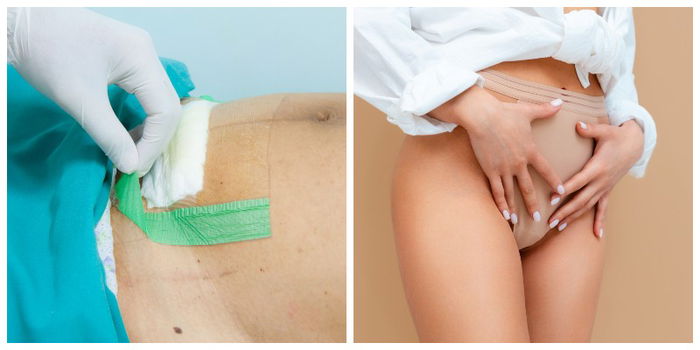 Mum's Guide on How to Care for Your Postpartum Wound - Vaginal or Cesarean Delivery