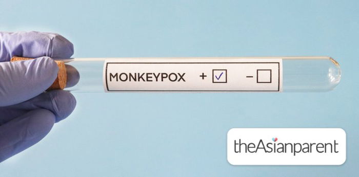 MOH Confirms New Imported Monkeypox Case
