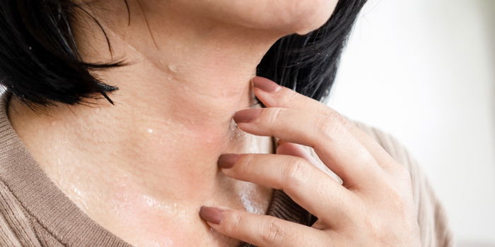 Surviving Excessive Sweating and Heat Rash During Pregnancy: Tips and Tricks for Relief