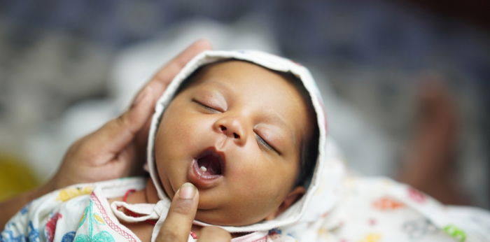 Baby Born With Teeth: Causes, Risk, Treatment, and Removal