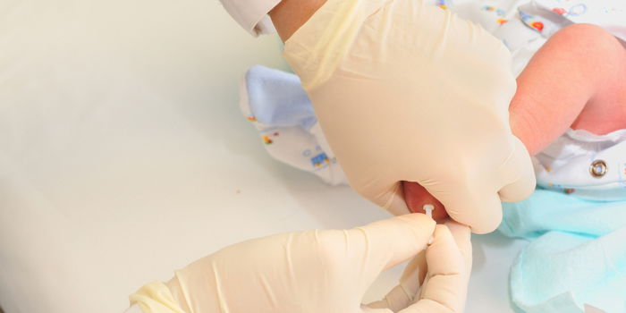 Heel Stick Test For Newborns: Is It Really Necessary?