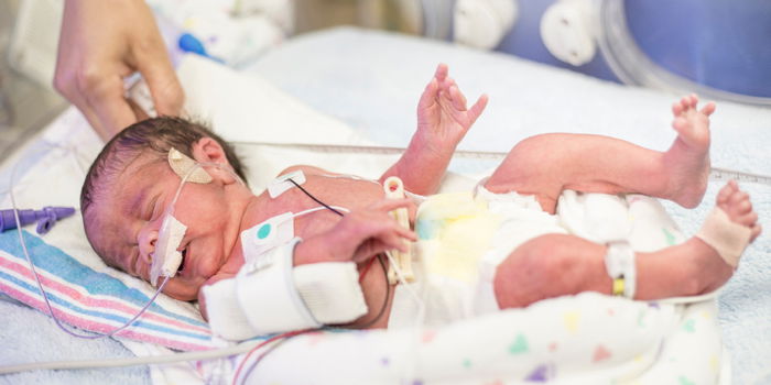 Patau Syndrome: Causes, Symptoms, and Life Expectancy of Diagnosed Babies