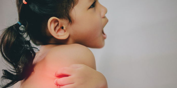 Fun in the Sun: Preventing and Treating Sunburn in Children