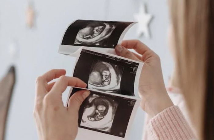 Chinese Firm Asks Employees to ‘Take Turns to Get Pregnant’ So Operations Won’t Be ‘Paralysed’, Sparks Debate Online