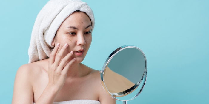 The Mask of Pregnancy: What Mums-to-Be Need to Know About Chloasma