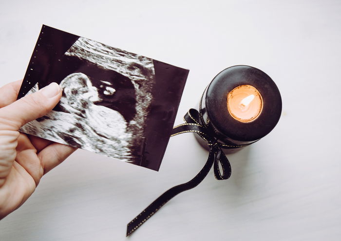 10 Heartfelt & Creative Baby Remembrance Ideas for Parents Coping with Miscarriage or Stillbirth