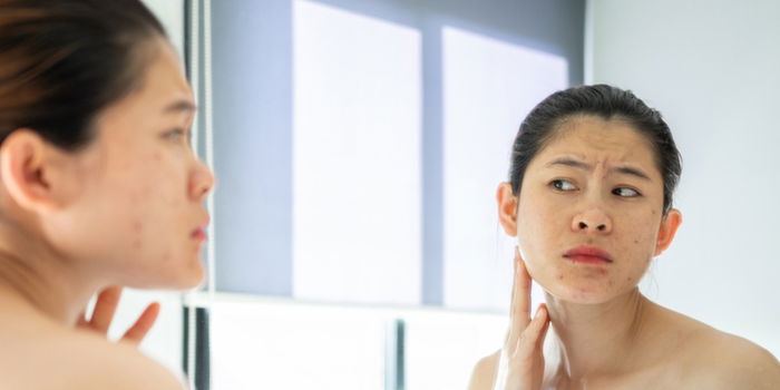 Clear Mind, Clear Skin: The Effects of Stress on Your Skin Health