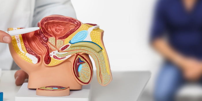 Help Your Man Detect Prostate Cancer Before It’s Too Late