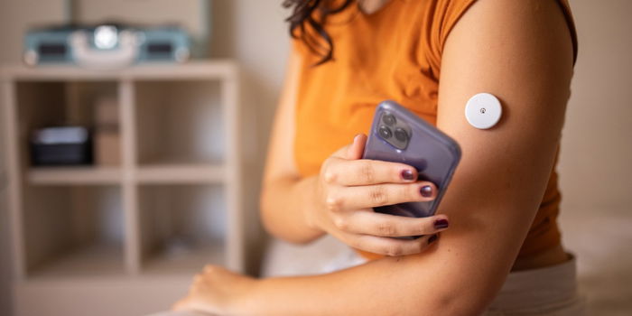 Keeping an Eye on Sugar: Understanding Continuous Glucose Monitors (CGMs)