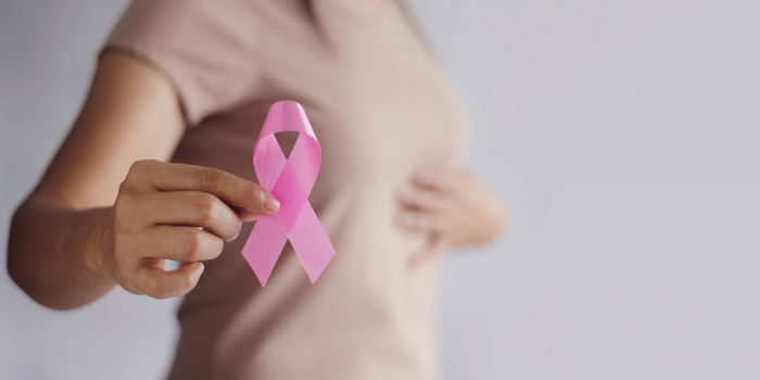 Navigating the Journey of After Breast Cancer Diagnosis