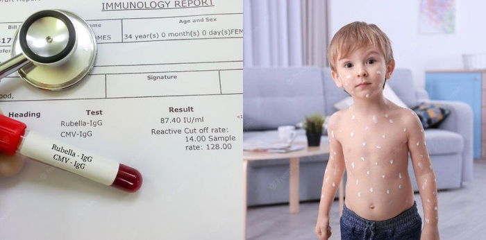 Baby Cramps: Causes, Symptoms, Treatment and Prevention Tips