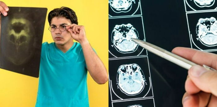 Learn More About Neurofibromatosis: Symptoms, Causes, and Risk Factors for NF1 and NF2