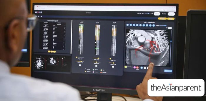AI System to Be Trialled at Three Singapore Hospitals for Faster Coronary Artery Disease (CAD) Detection