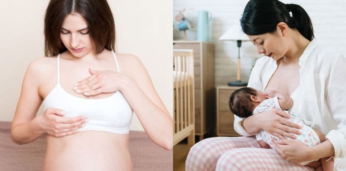Blocked Breast Milk Duct: Symptoms, Causes, and How to Treat It