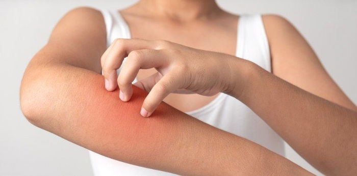 Itchy skin? 8 possible causes of your skin itching