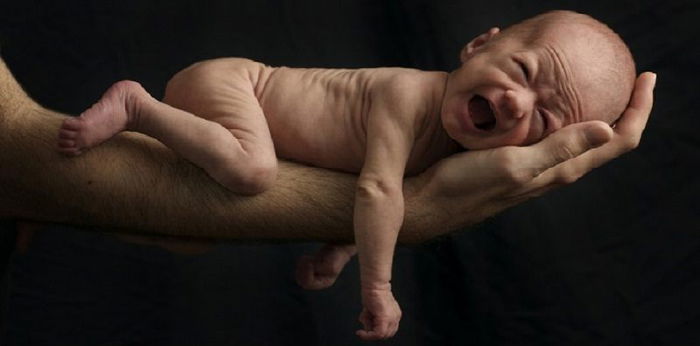 Skinny Baby Worries? Parents Must Know the Causes and How to Deal With It
