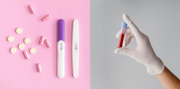 Getting to Know the Plano Test, an Examination to Confirm Pregnancy