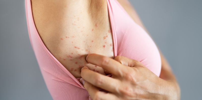 Pregnant women have bumps under their armpits. What causes them? How worried should I be?