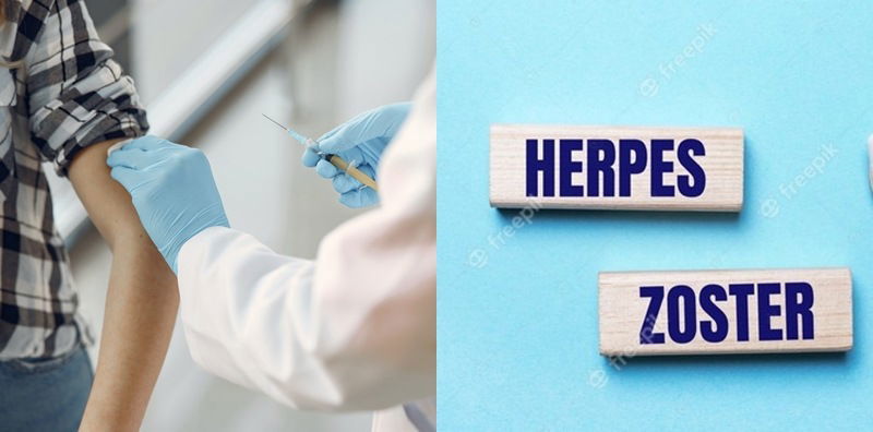 Herpes Zoster Vaccine: General Explanation, Effectiveness, and Side Effects