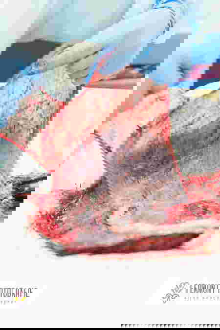 nhau-thai-cua-be-so-sinh